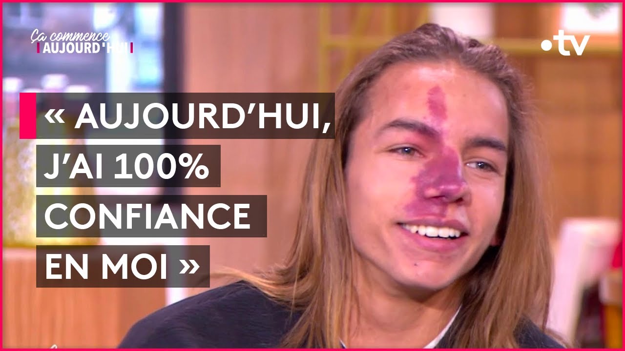 Angiome : la rencontre de Gabin avec Jean-Luc Reichmann qui a tout changé - Ça commence aujourd'hui