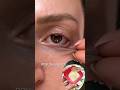 Vanish Dark Circles In Days.💥✅#foryou #youtubeshorts #darkcircles #viral