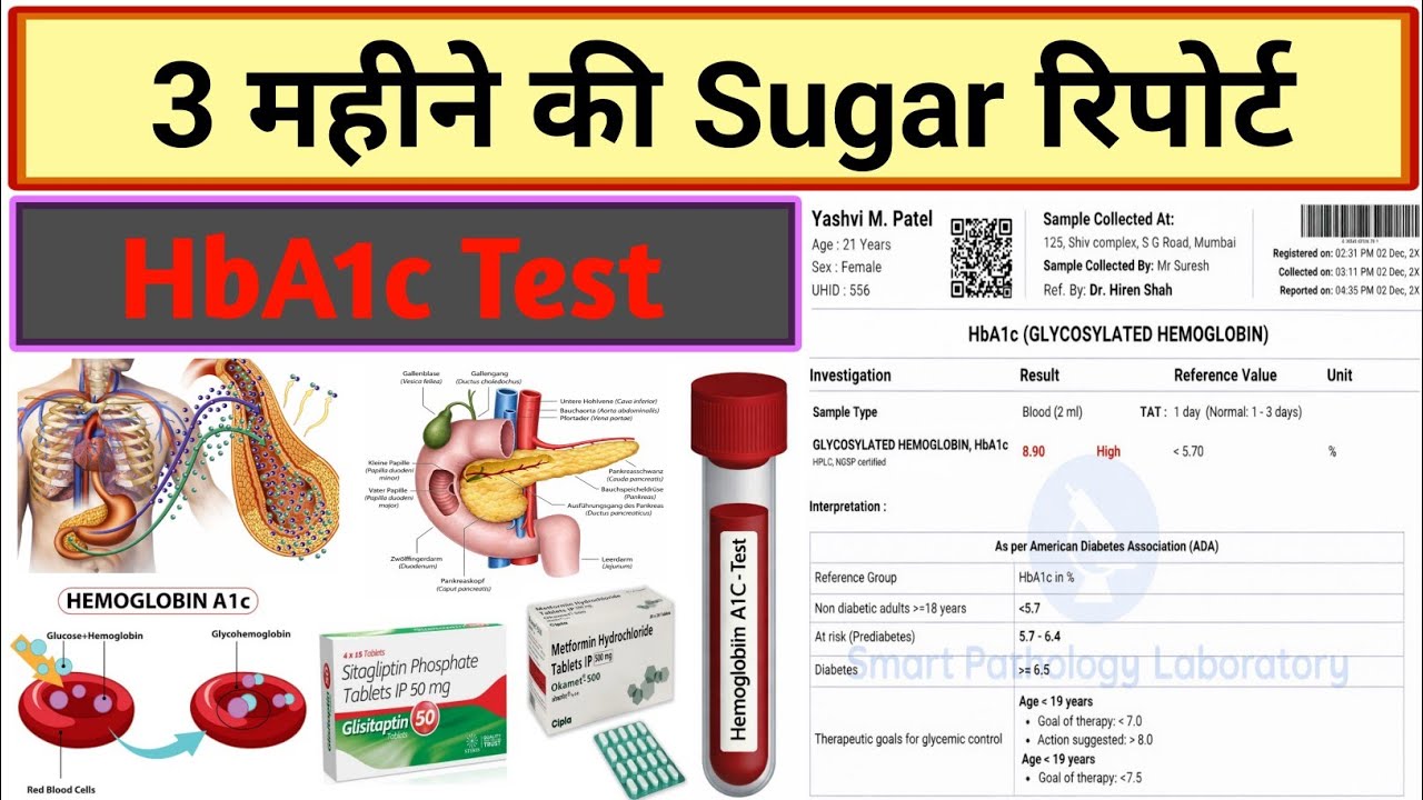 Fbs Rbs Test 3 महीने पुरानी शुगर | HbA1C Test | Diabetes | Treatment | Medicine ...