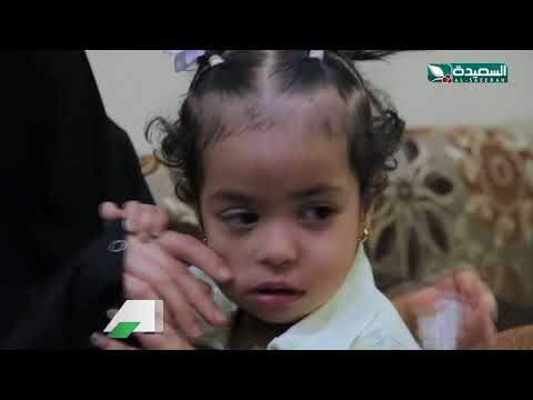 معاناة إسماعيل حسن مع مرض قلبي وراثي نادر | سنابل الخير