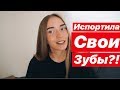 Что У Меня С Зубами?! ♡ Вся Правда О Винирах ♡ Жалею, что сделала?