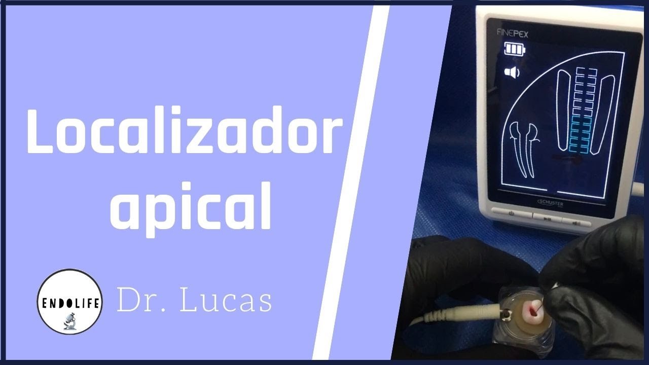 PASSO A PASSO DO LOCALIZADOR APICAL.