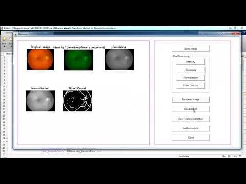 Project Image Processing | Thesis Image Processing | Project Code Image Processing