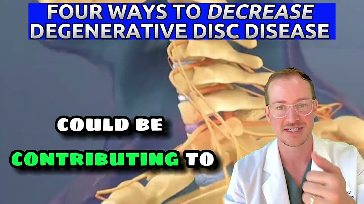 𝟰 𝗪𝗮𝘆𝘀 𝘁𝗼 𝗗𝗲𝗰𝗿𝗲𝗮𝘀𝗲 𝗗𝗲𝗴𝗲𝗻𝗲𝗿𝗮𝘁𝗶𝘃𝗲 𝗗𝗶𝘀𝗰 𝗗𝗶𝘀𝗲𝗮𝘀𝗲 (Spine Surgeon Explains)