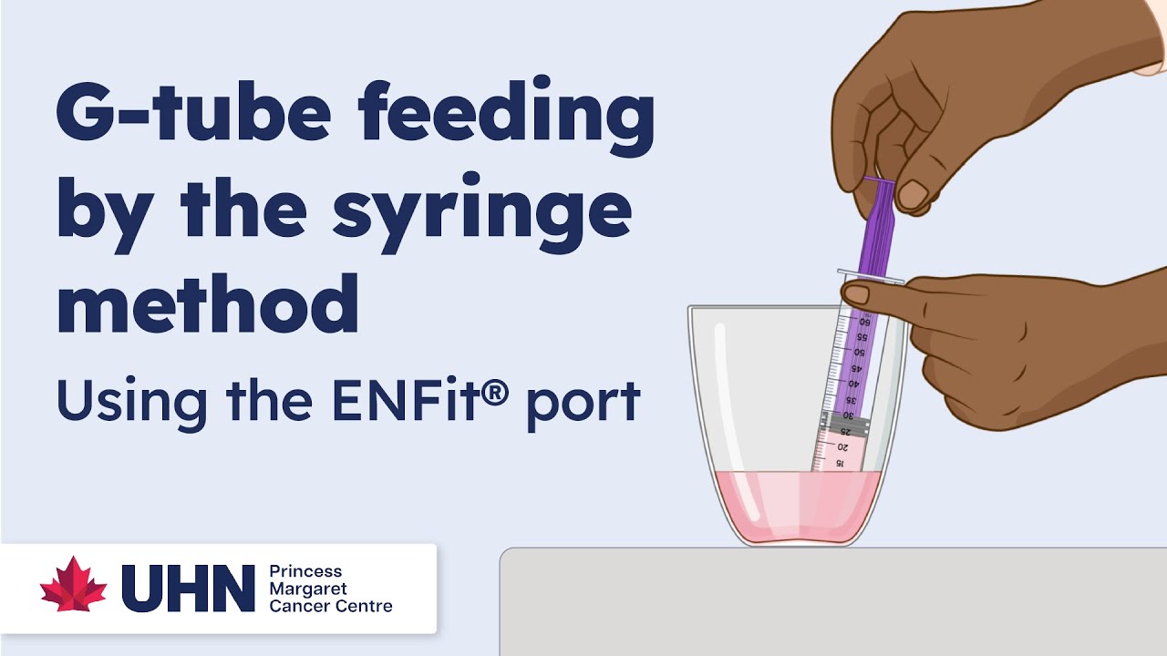Питание через гастростомическую трубку методом шприцевого введения – с использованием порта ENFit®
