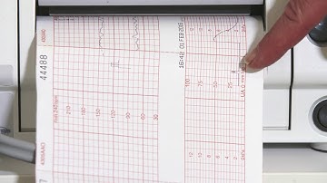 Training session 5 -  Trace Identifiers for your Monica Novii Wireless Patch System