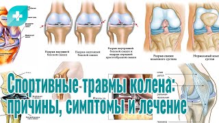 Спортивные травмы колена: причины, симптомы и лечение