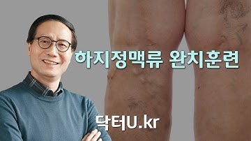 하지정맥류 완치훈련