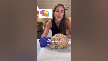 🧠 The Human Nervous System! 🧠 #anatomy #humanbody #brain #science #scienceteacher