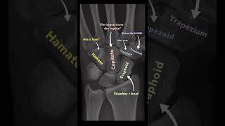 Carpal bones Anatomy anatomy shorts physicaltherapy fitness