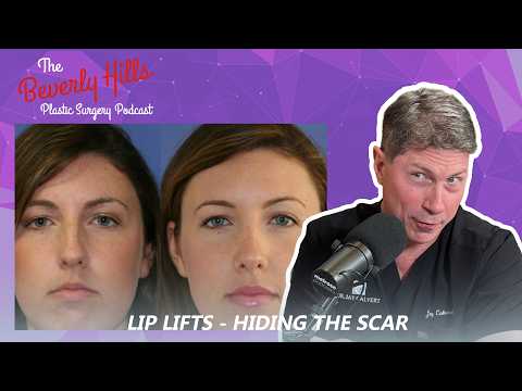 Ep. 346 - Lip Lift - Hiding The Scar | The Beverly Hills Plastic Surgery Podcast