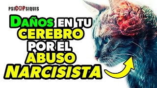 Conoce los DAÑOS en TU Cerebro x el Abuso Narcisista y Cómo cuidar Tu Salud Mental para RECUPERARTE