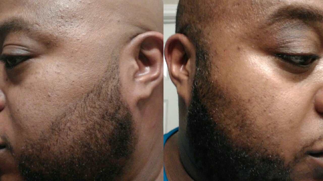 BEARDS: Ultimate How To Reset Your Beard Line; Beard Tutorial 4K - YouTube
