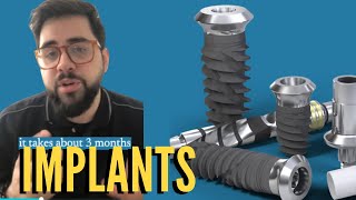 Everything about dental implants | Dental Treatment | MJB CARE