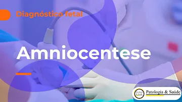 Como é feito o exame de líquido amniótico?