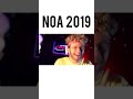 Noa 2024 😒 VS Noa 2019 😄 #shorts #noa