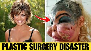 15 SHOCKING Celebrity Transformations - You Won't Recognize Them in 2026 | Then and Now 2026 Wealth