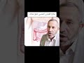 طبق لحالك علاج القولون