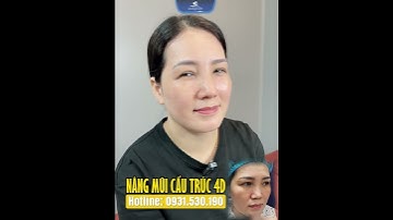Nâng mũi cấu trúc 4D - Tái tạo dáng mũi đẹp hài hòa, cân đối