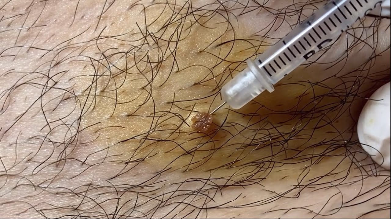 Shakiraning yalangoch suratlari Jinsiy olatni qin ichiga video ichiga kiradi