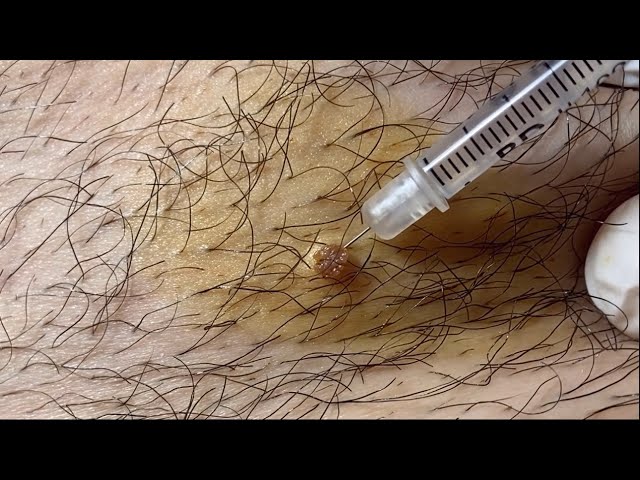 Men esa lezbiyan dostimdan oshib ketdim Miros yosh porno