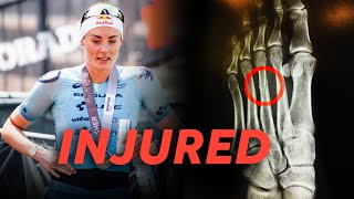 Freak Injury | Pro Triathlete