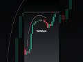 Trading  #shorts #sharemarket #trading #kkmstockvision