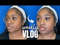 vlog: i got lip injections (black people get fillers too)