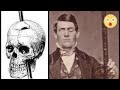 15 TRUE Disturbing Stories From Reddit