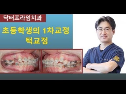 [치아교정] 턱교정 초등학생의 치아교정시기와 1차교정