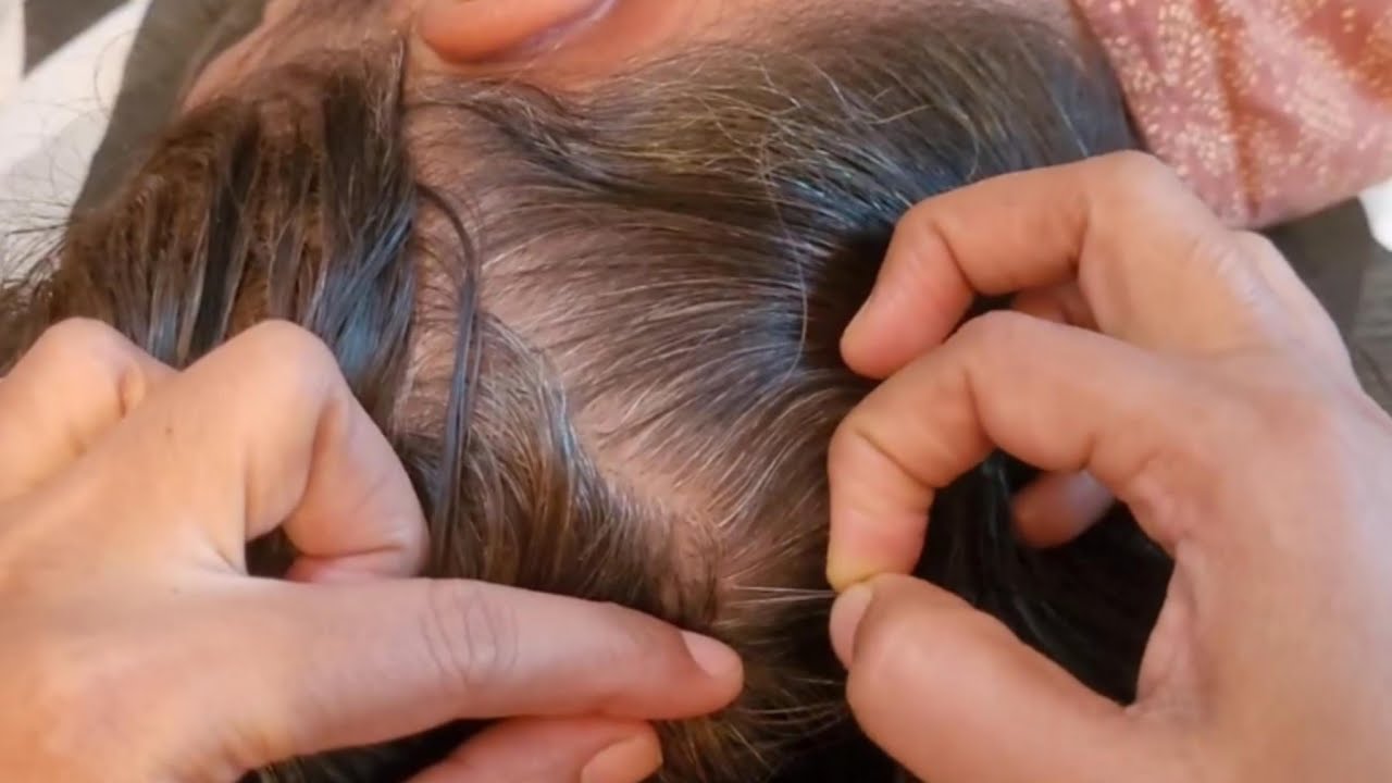 ASMR - Hair Parting, & Close - Up Inspection & Scalp Check For Deep Sleep ✨🌿