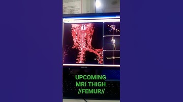 Brachial plexus #mri philips 3T #shortsvideo