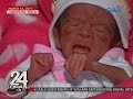24 Oras: Premature baby na ubod nang liit, normal na ang kalagayan matapos ang 2 buwang gamutan