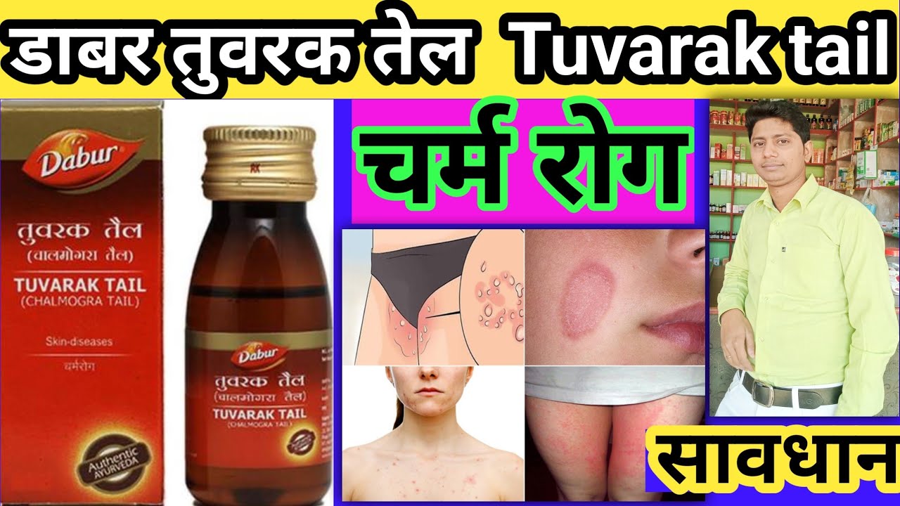 तुवरक तेल के फायदे Dabur chalmogra oil ke fayde charm rog ki dava