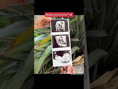 Maddy Est Enceinte