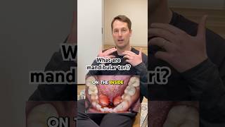 What are mandibular tori?