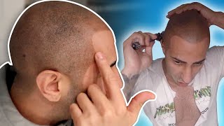 What Happens When You Shave Off A Hair Tattoo?