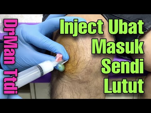 INJECT LUTUT SAKIT OSTEOARTHRITIS - @DrMan Ttdi