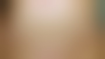 Difficult Laparoscopic Appendicectomy For Retrocecal Appendix With Abscess | Dr. Imran Abdullah Khan