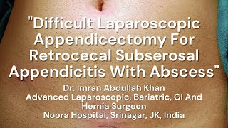 Difficult Laparoscopic Appendicectomy For Retrocecal Appendix With Abscess | Dr. Imran Abdullah Khan