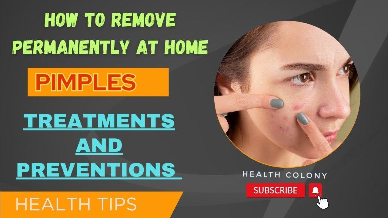 how-remove-pimples-and-dark-spots-permanently-ii-say-goodbye-to-pimples