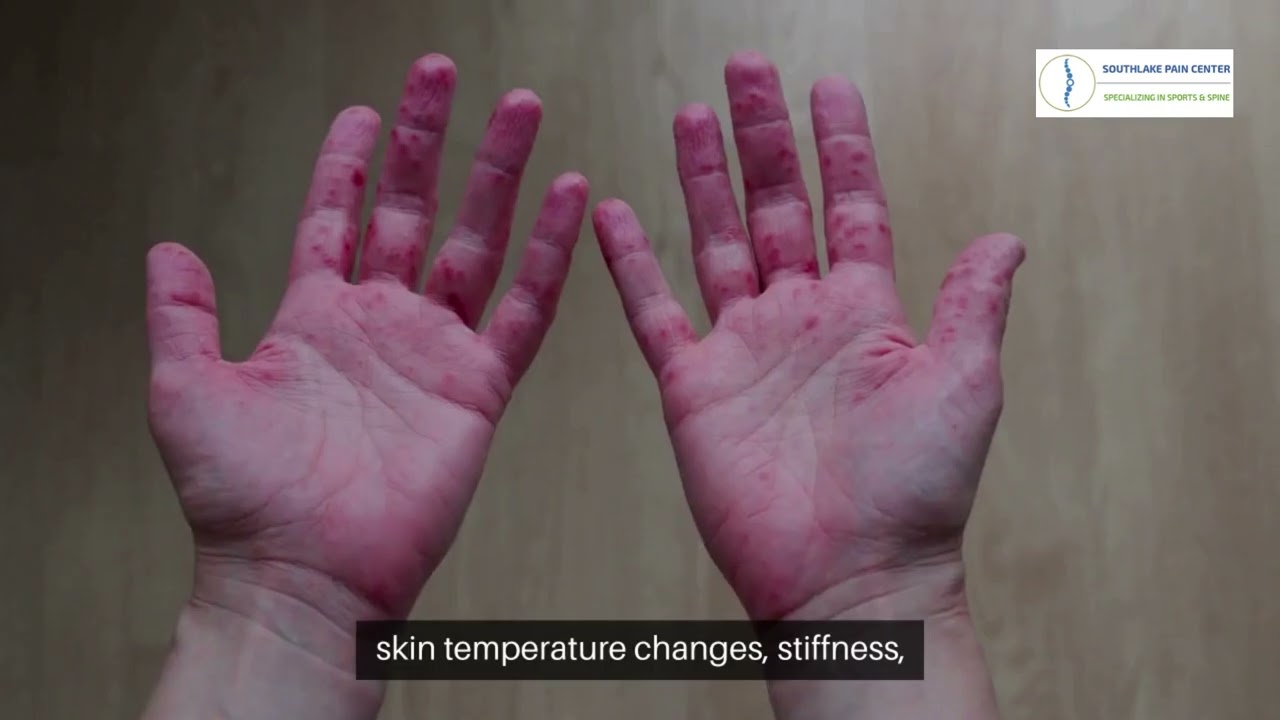 CRPS Treatment in Southlake | Options for Pain Management