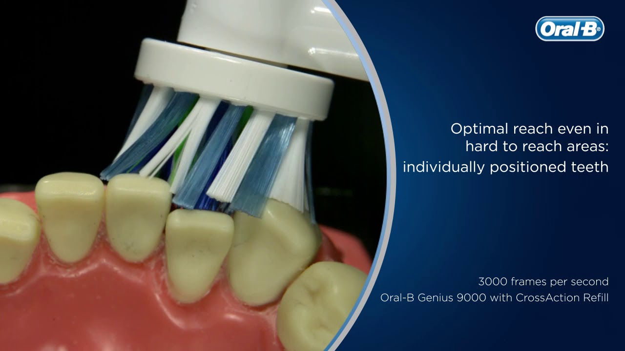 OralB's Electric Brush vs. Regular Toothbrush Who Wins? OralB YouTube