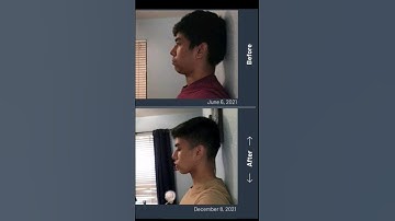 4 month mewing results 😈