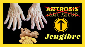 ¿Es bueno el jengibre para la artritis?