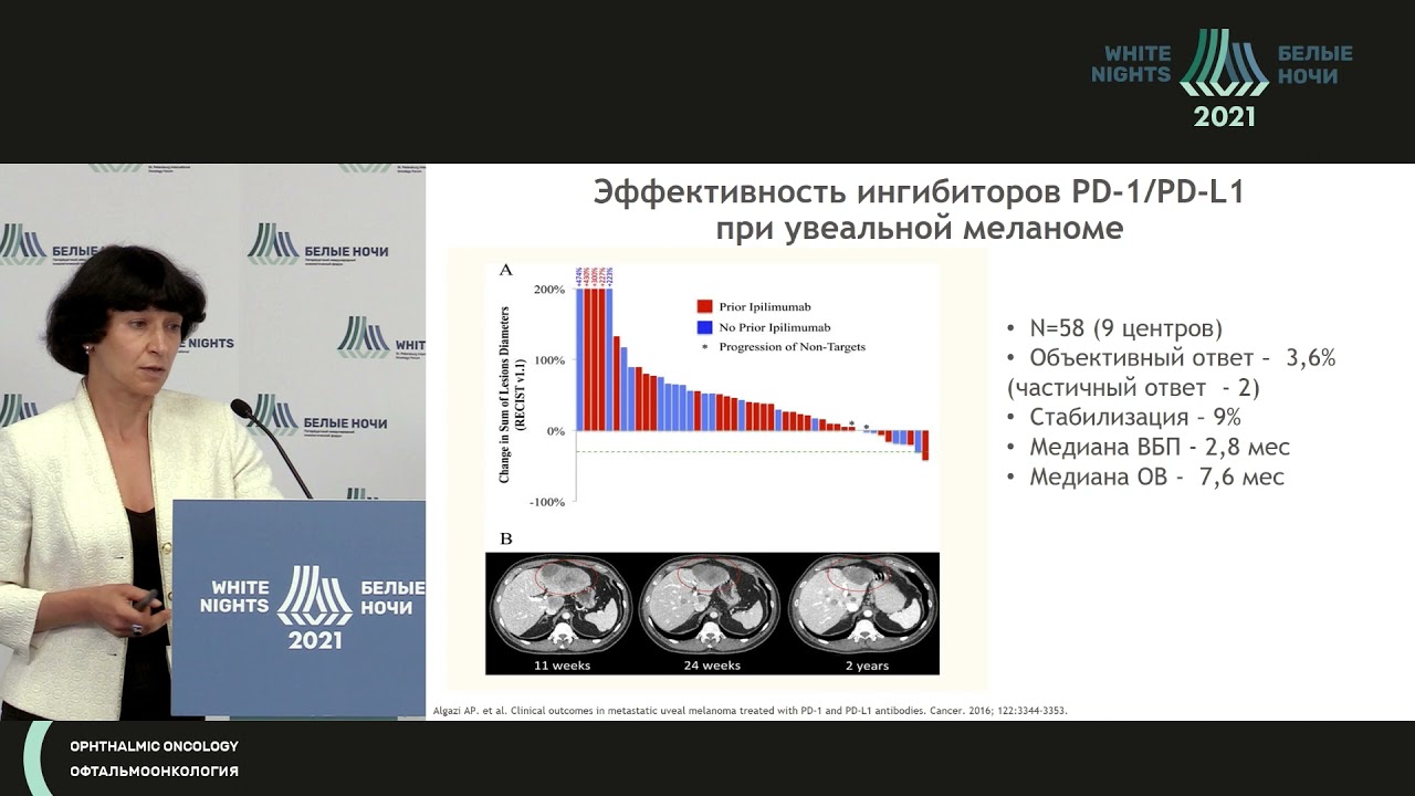 Лекарственная терапия у пациентов с распространенной формой меланомы глаза (Семенова А.И.)