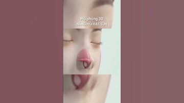 Mô phỏng 3d nâng mũi đặt sụn