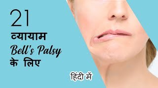 21 व्यायाम BELL'S PALSY के लिए (HINDI)