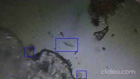 Motion detection in microscope videos using Python and OpenCV