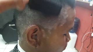 ini dia penyebabnya dan cara penanganan psoriasis di kepala!!